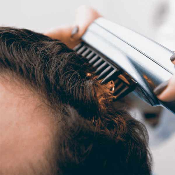 Terapia laser o LED per combattere la caduta dei capelli