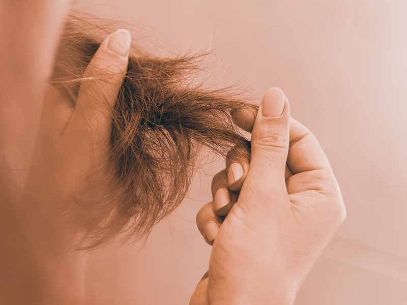 Trapianto di capelli artificiali: cosa devi sapere