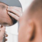 5 fasi di ricrescita dopo un trapianto di capelli