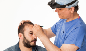 Trapianto di capelli in Turchia