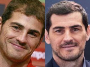 Atleti famosi con trapianto di capelli - Iker Casillas